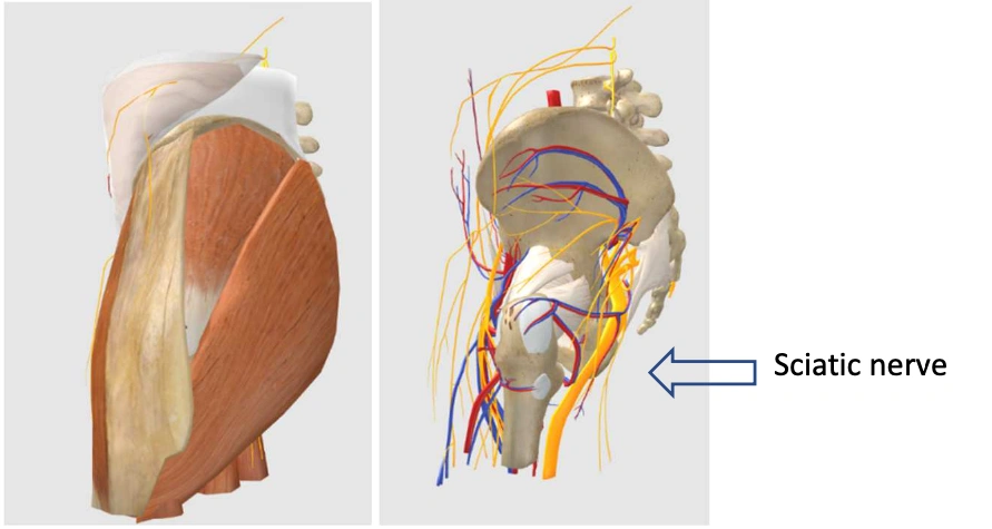 Lateral view approach femoral head and same position after removing the muscles